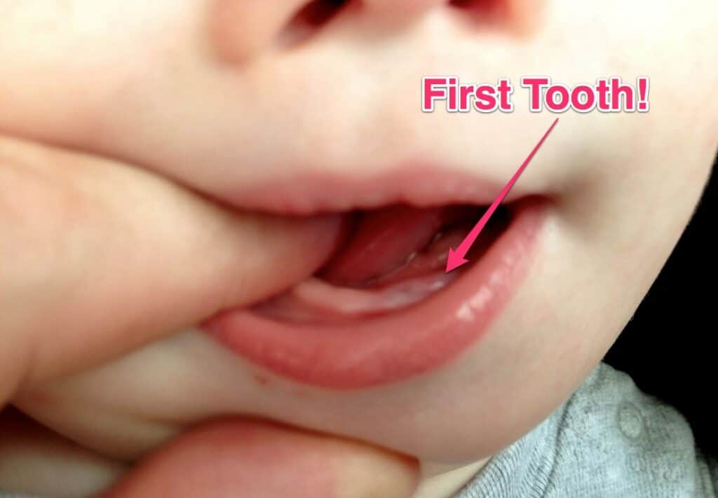 What Baby Teeth Comes in First by Parenting How To